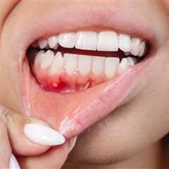 Comprehensive Guide to Receding Gums Treatments -