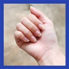 Here’s What Certain Changes In Your Nails Can Reveal About Your Health, According To Dermatologists