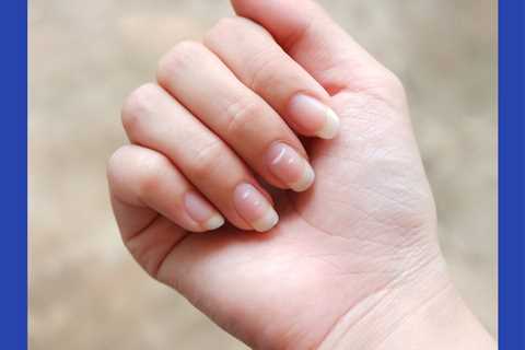 Here’s What Certain Changes In Your Nails Can Reveal About Your Health, According To Dermatologists