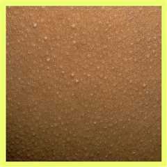 A Photo Guide To 20 Types Of Skin Bumps You Might Find On Your Body